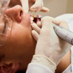 Interdental Brushes: Efficient Cleaning Tips